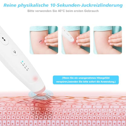 Soarfly - Mosquito Bite Heat Pen for Quick Relief from Itching & Swelling